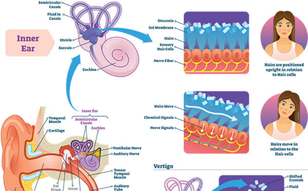 Dizziness Care:  Why am I dizzy ?